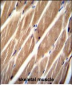 PIP5KL1 Antibody (N-term)